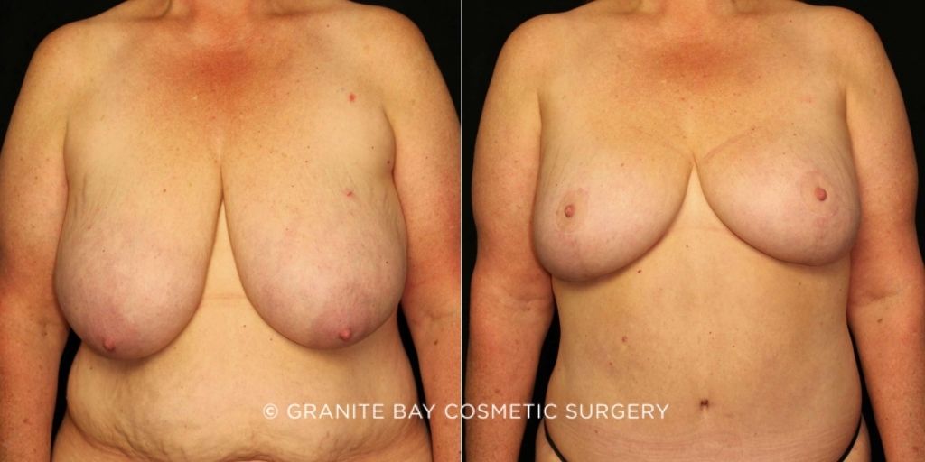 Case # 3 after photo