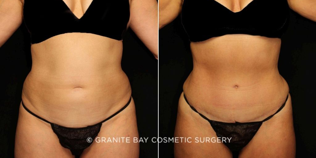 Case # 8 after photo