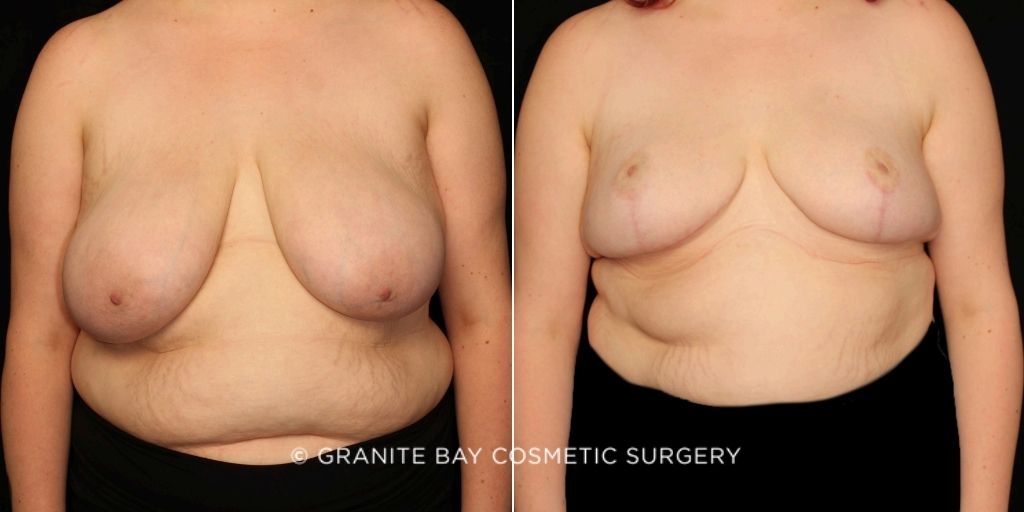 Case # 4 after photo