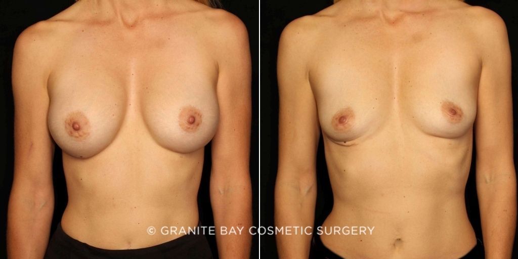 Case # 1 after photo