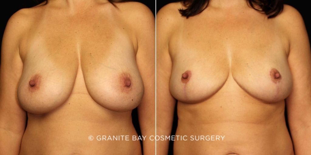 Case # 5 after photo