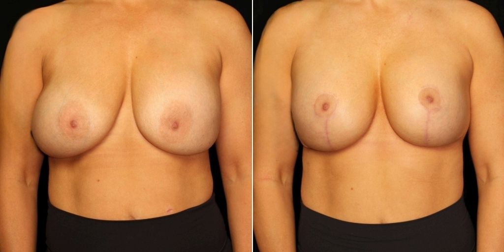 Case # 3 after photo