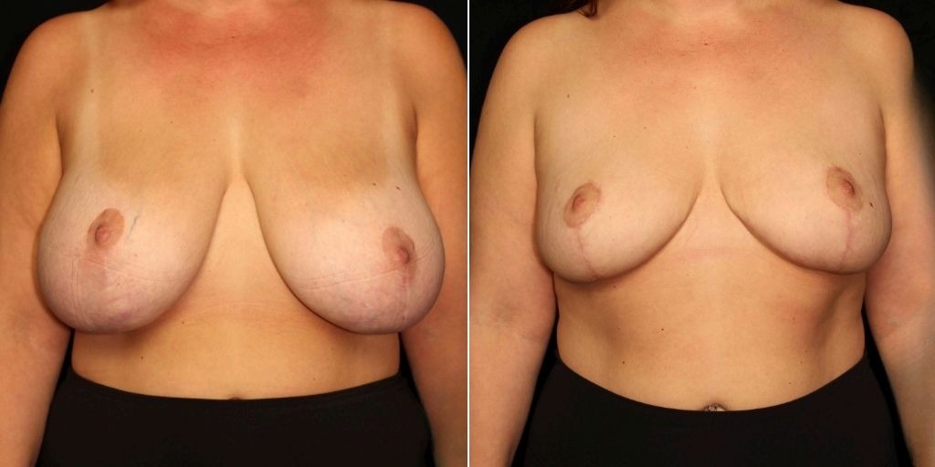 Case # 19 after photo