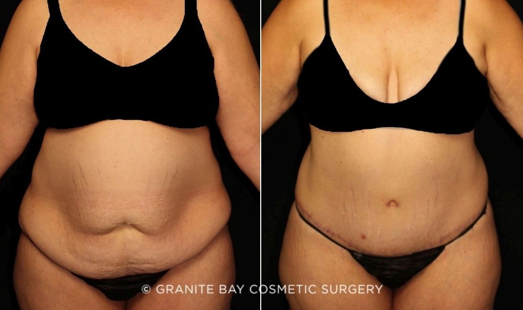 Case # 6 after photo