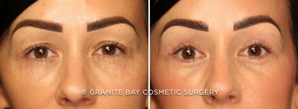 Case # 6 after photo