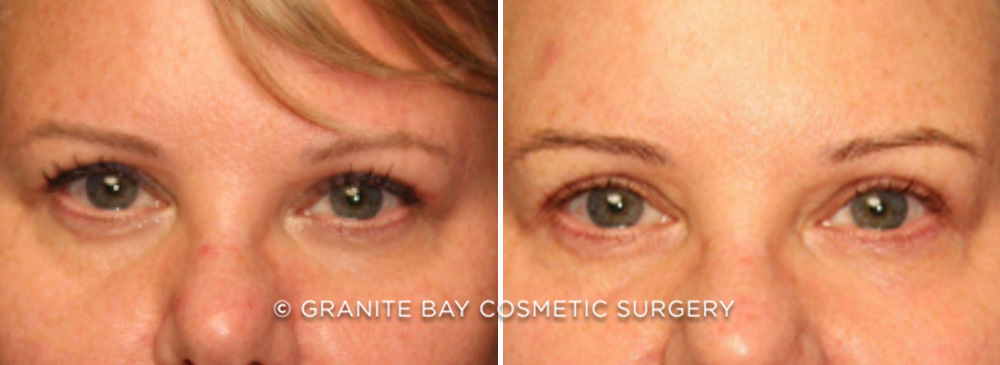 Case # 7 after photo