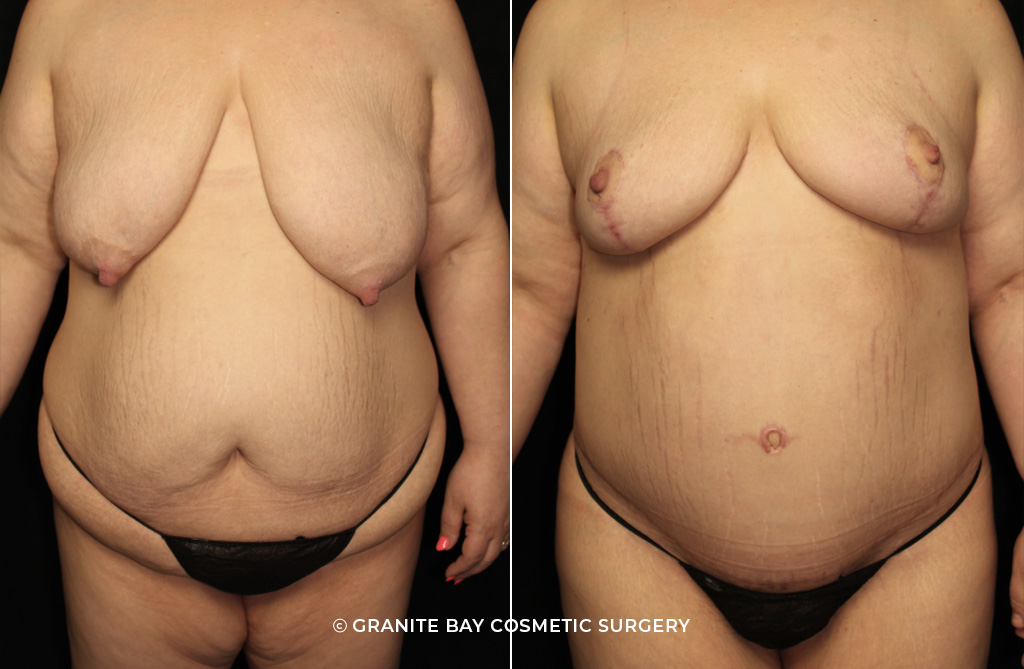 Case # 7 after photo