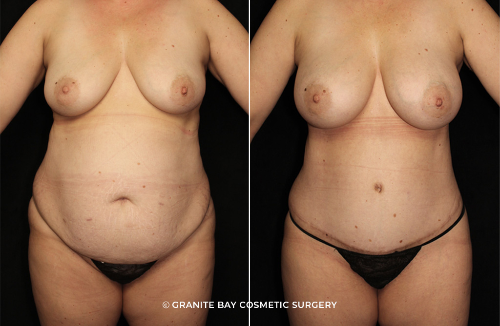 Case # 9 after photo