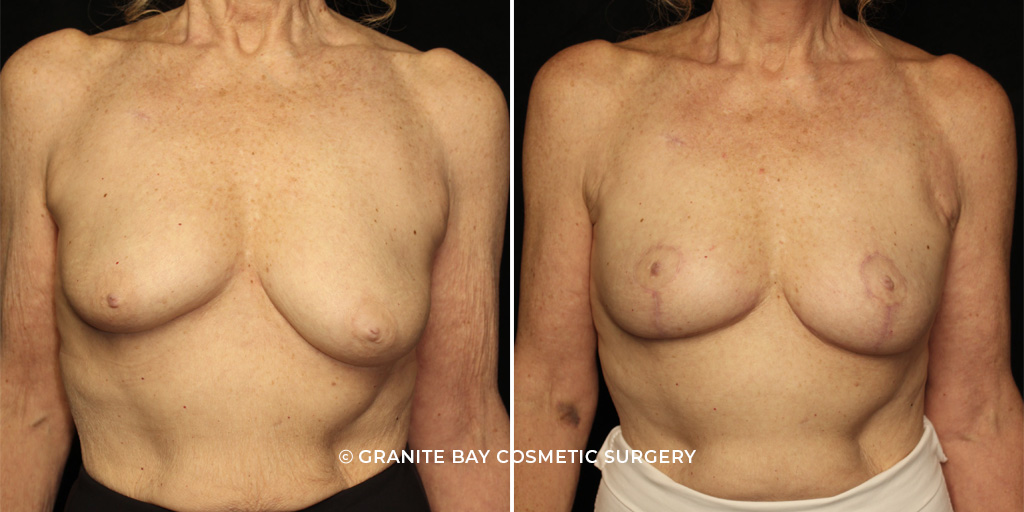 Case # 1 after photo