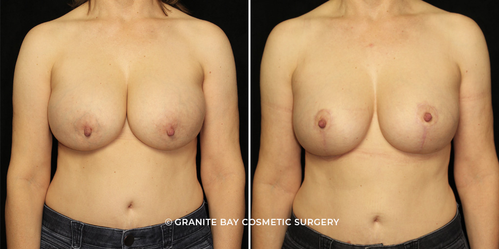 Case # 4 after photo