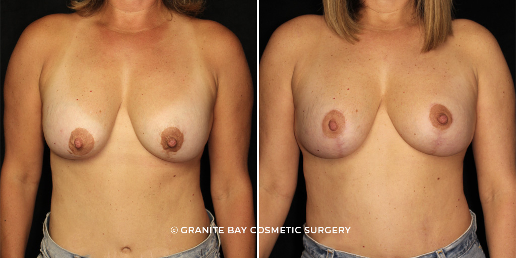 Case # 5 after photo