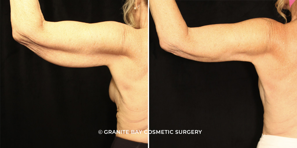 Case # 3 after photo