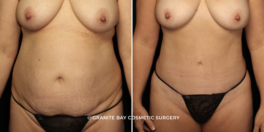 Case # 13 after photo