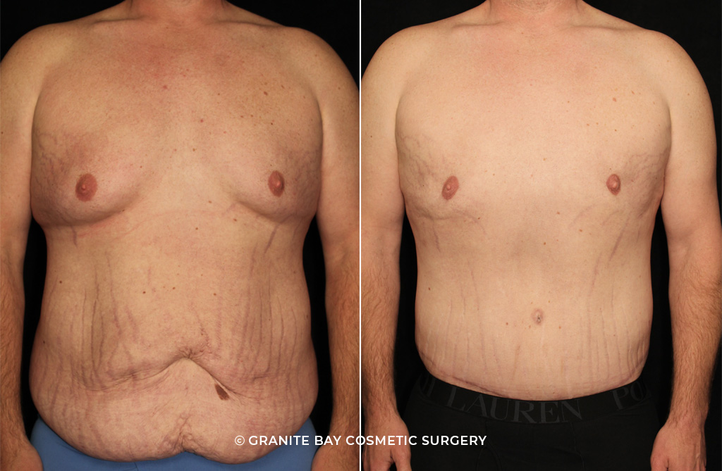 Case # 2 after photo