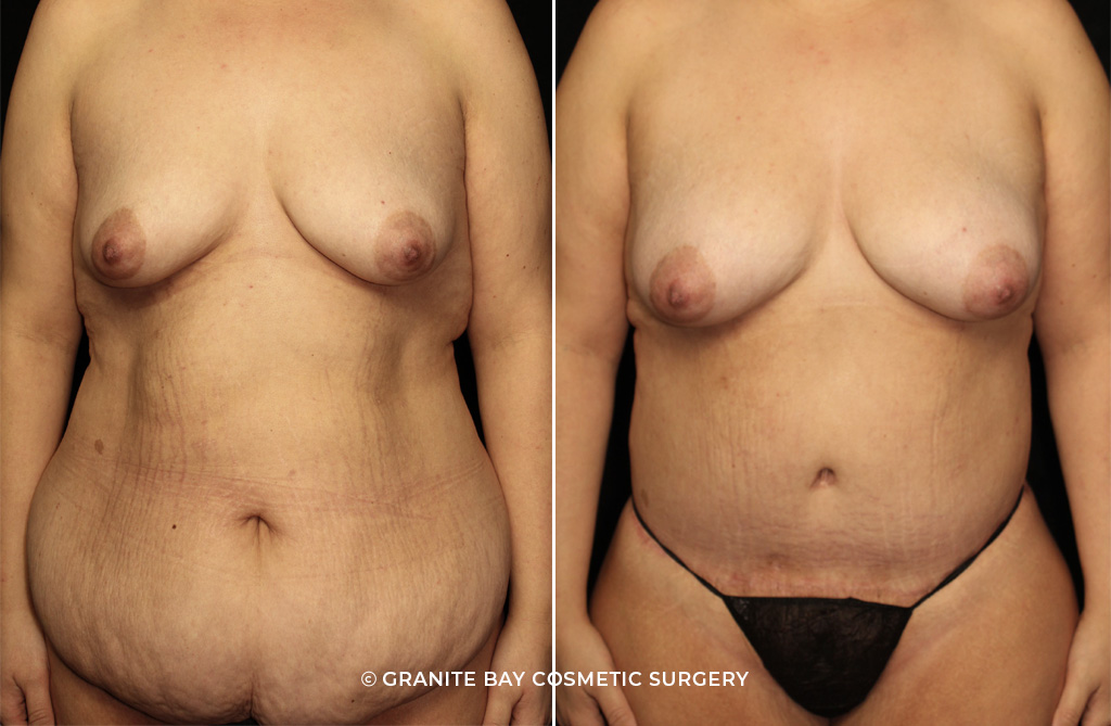 Case # 3 after photo