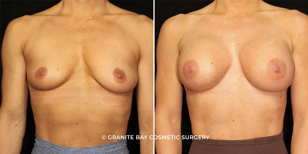 Case # 5 after photo