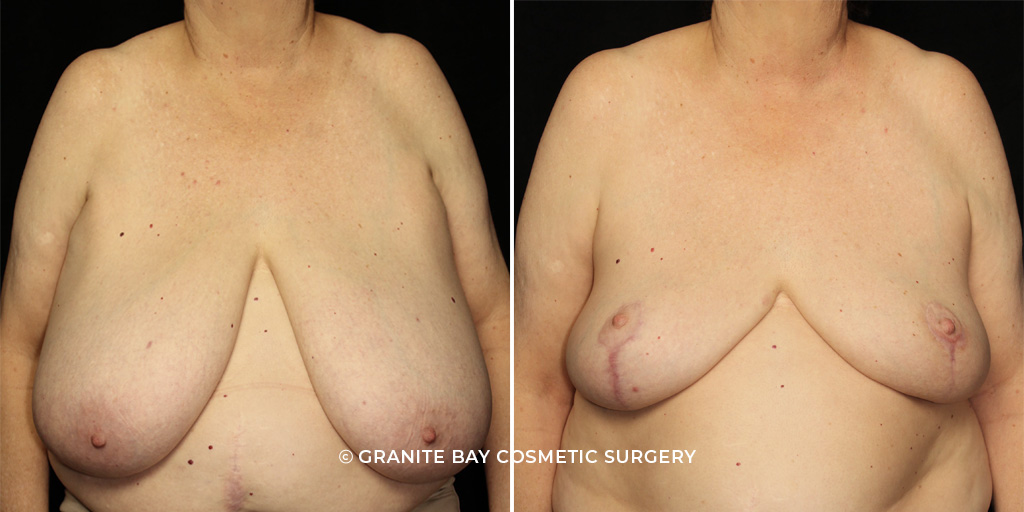 Case # 6 after photo