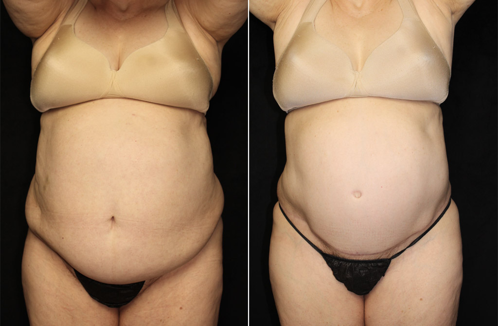 Case # 3 after photo