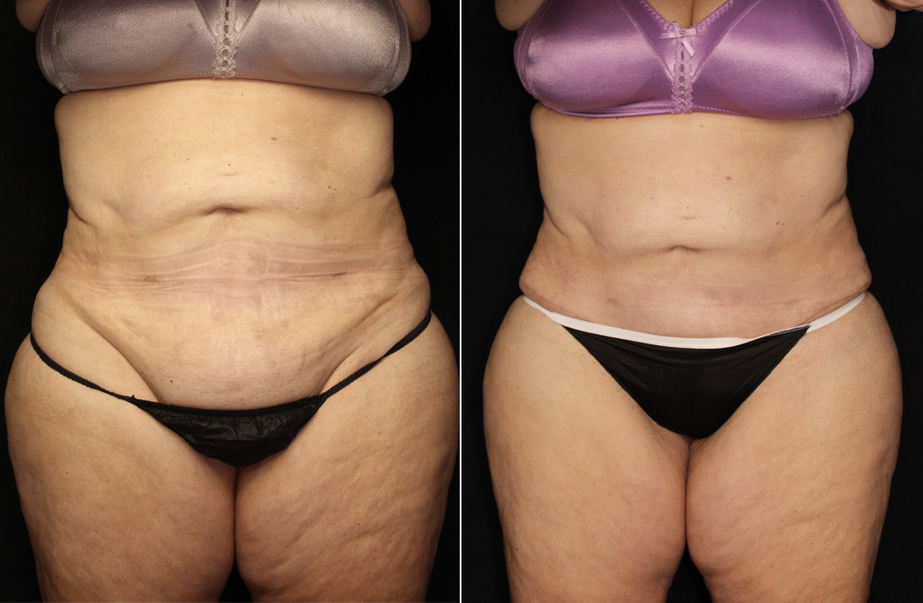 Case # 4 after photo