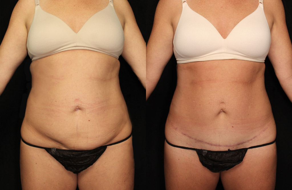 Case # 7 after photo