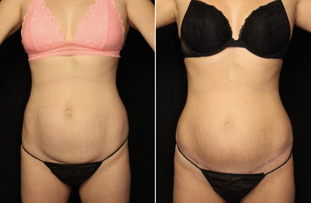 Case # 8 after photo