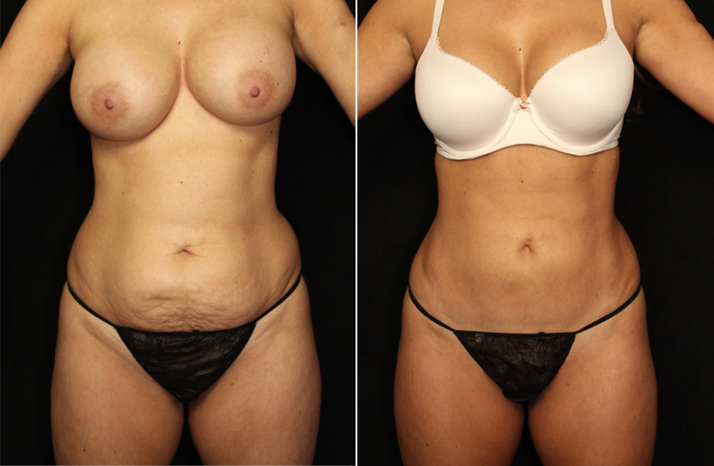 Case # 10 after photo