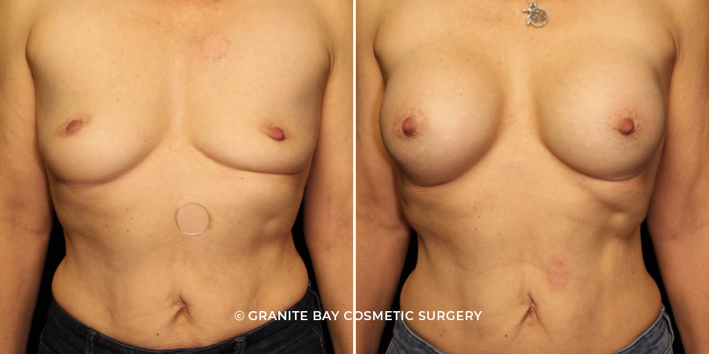 Case # 8 after photo