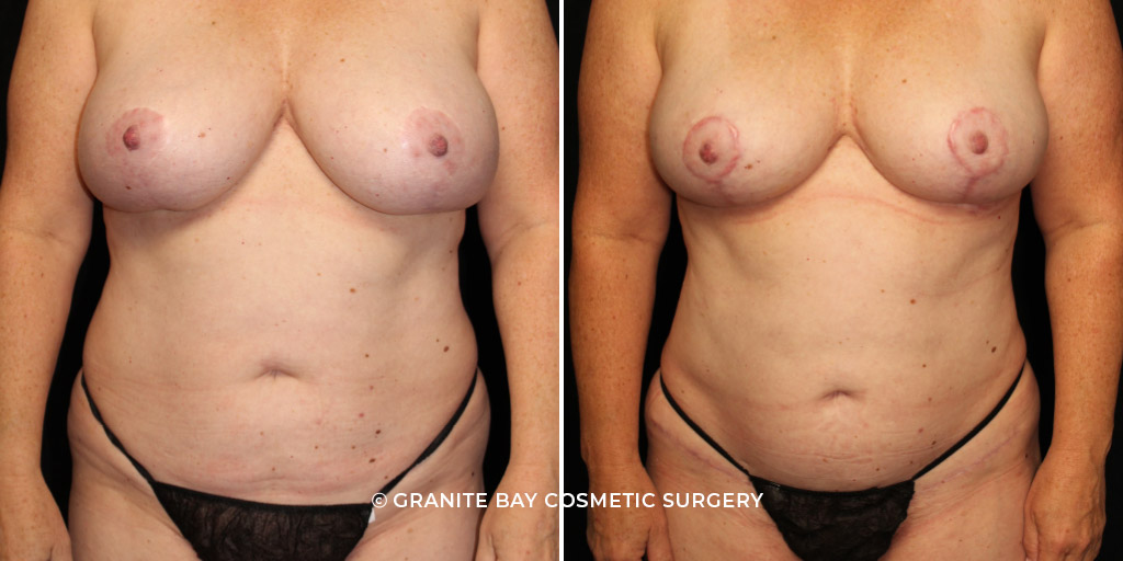 Case # 60 after photo