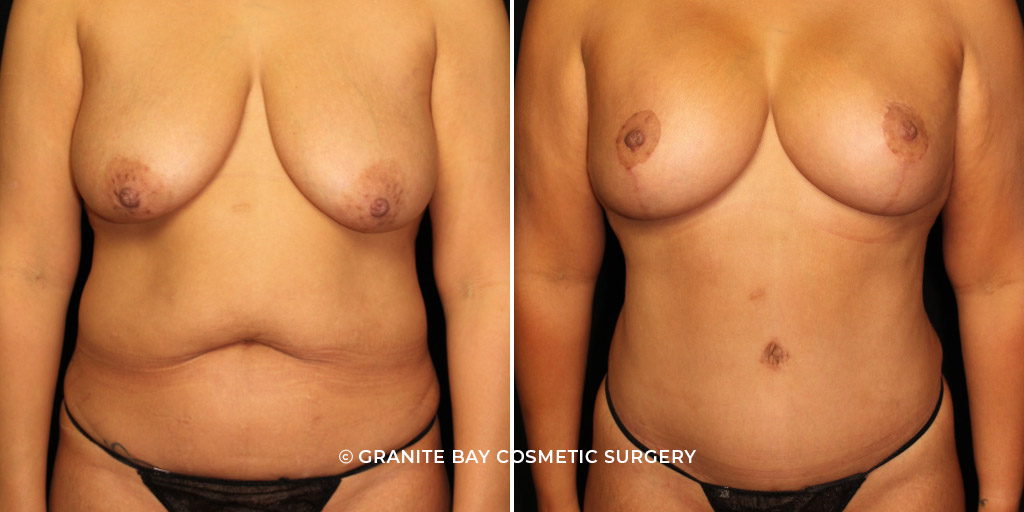 Case # 59 after photo