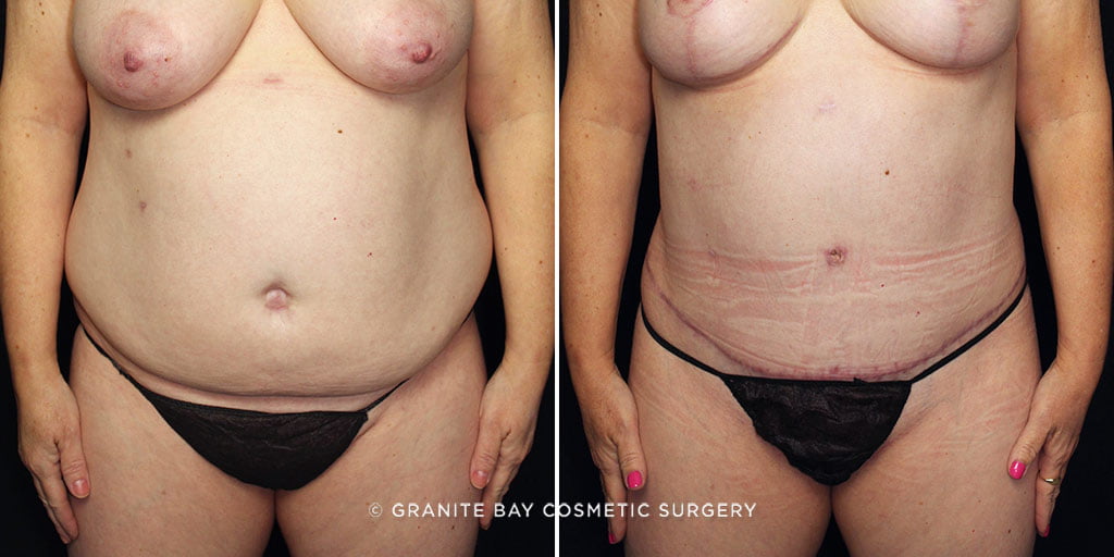 Case # 20 after photo