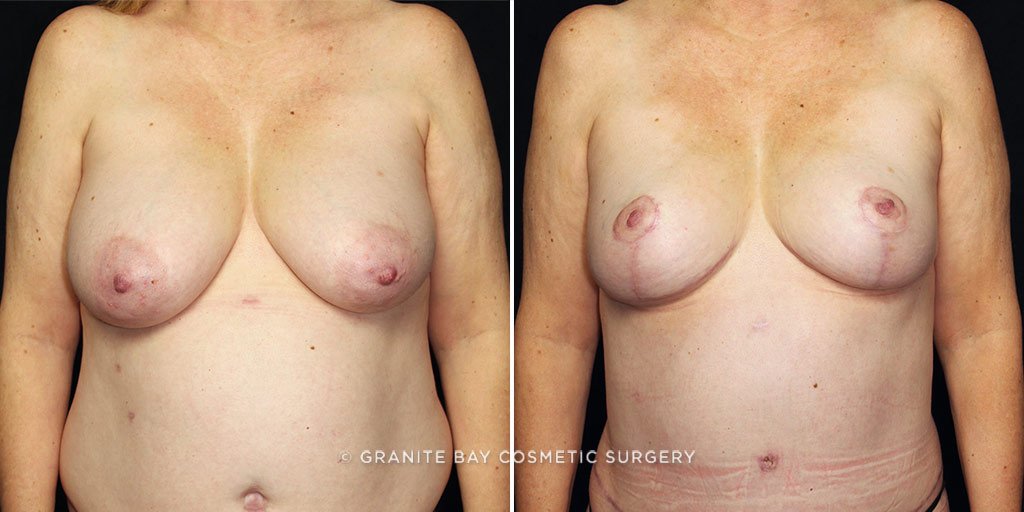 Case # 2 after photo