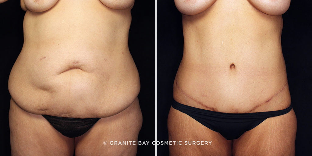 Case # 21 after photo