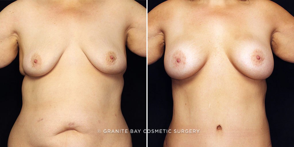 Case # 10 after photo