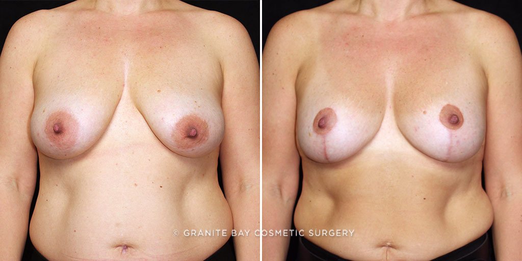 Case # 11 after photo