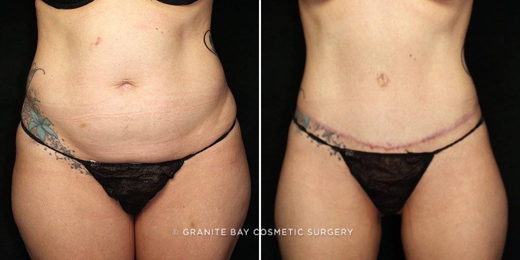 Case # 22 after photo