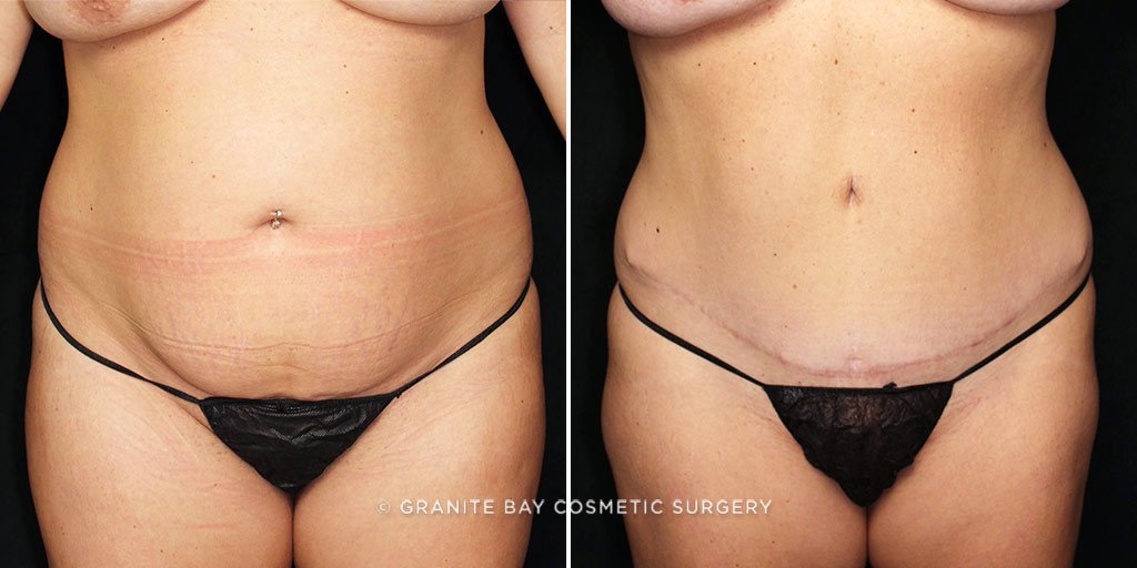 Case # 23 after photo