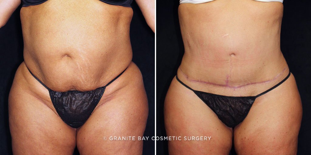 Case # 24 after photo