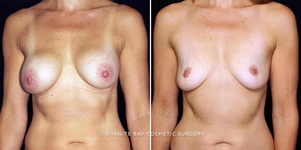 Case # 5 after photo