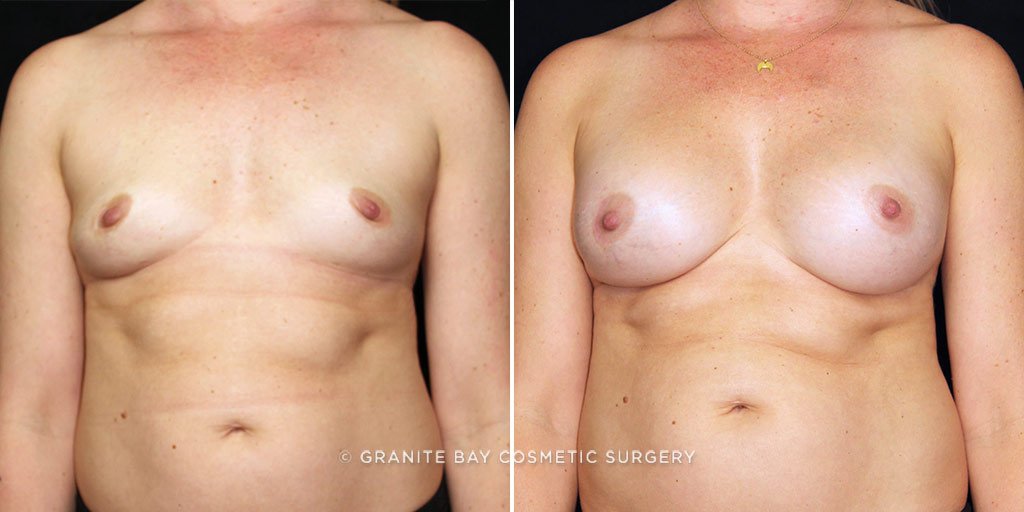 Case # 14 after photo