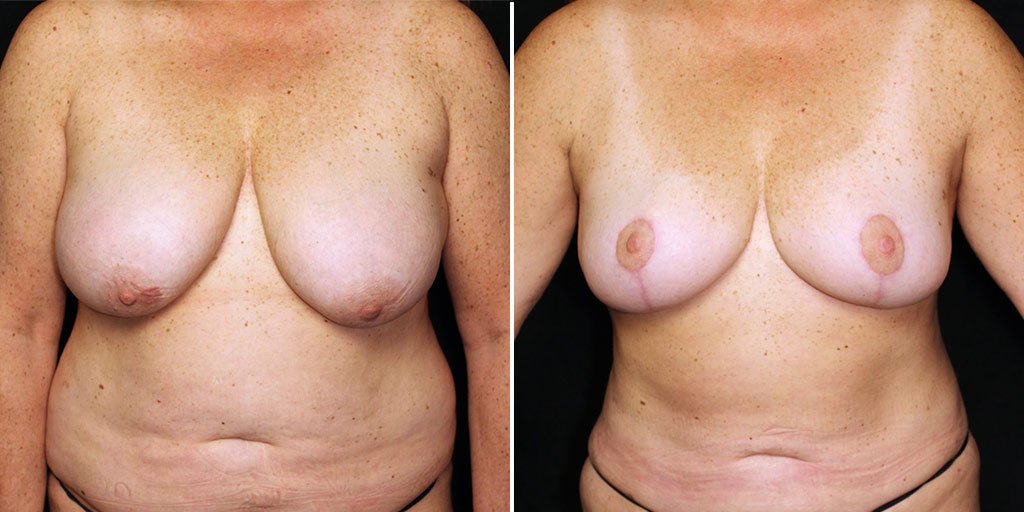 Case # 9 after photo