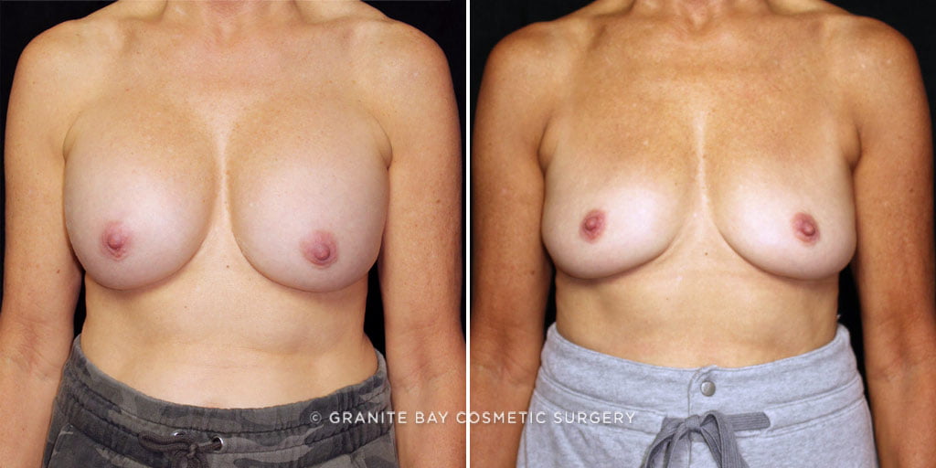 Case # 7 after photo