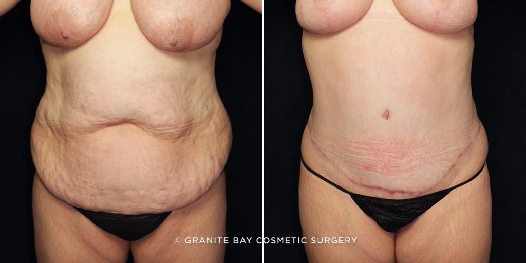 Case # 25 after photo