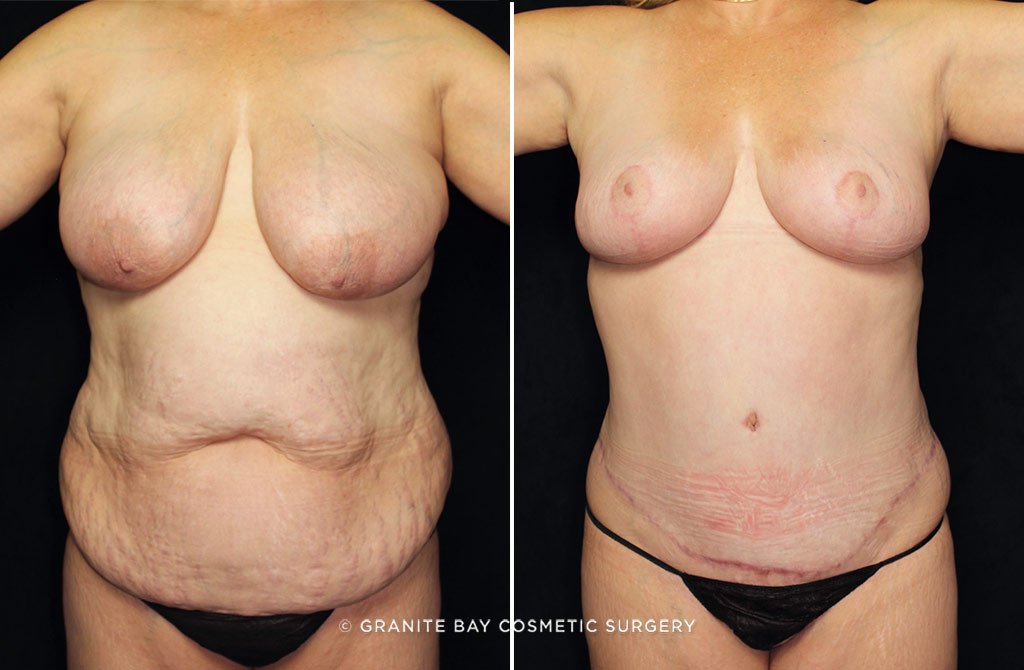 Case # 13 after photo