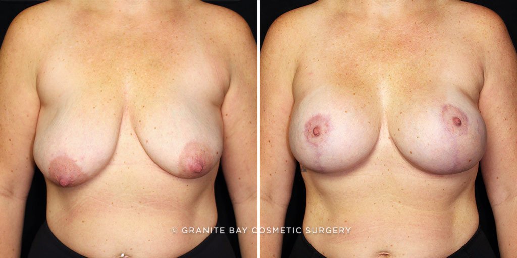 Case # 6 after photo