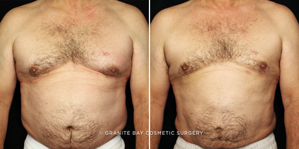 Case # 1 after photo