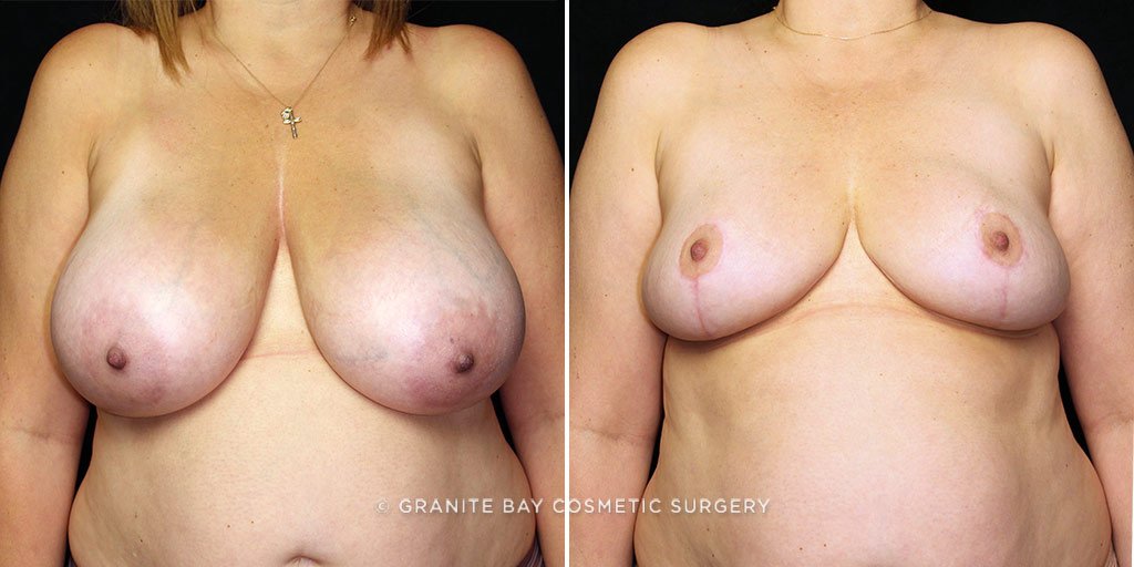 Case # 10 after photo