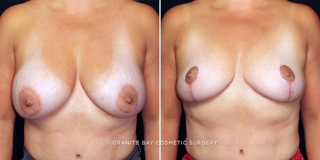 Case # 8 after photo