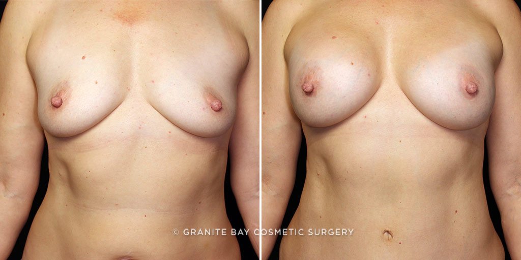 Case # 16 after photo