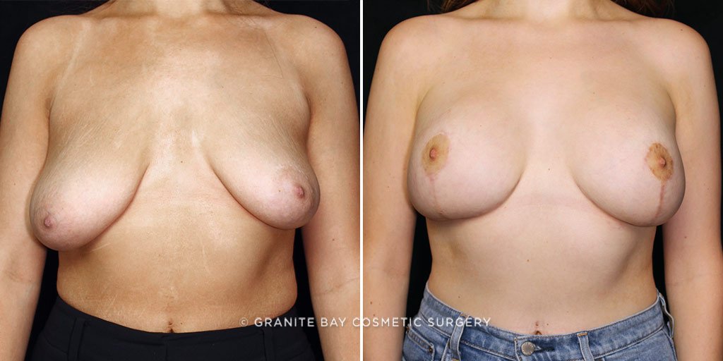 Case # 7 after photo