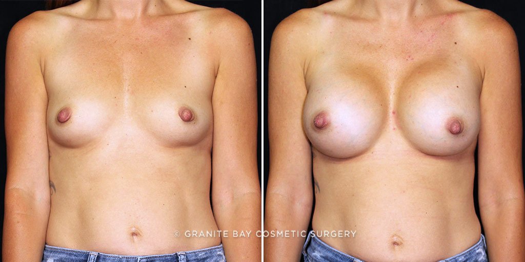 Case # 17 after photo